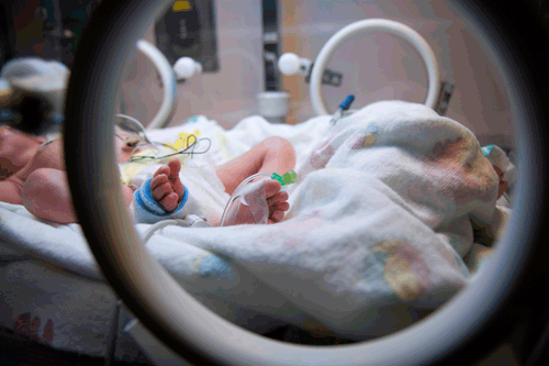 Preemie    Care:    Outside    of    the    Box