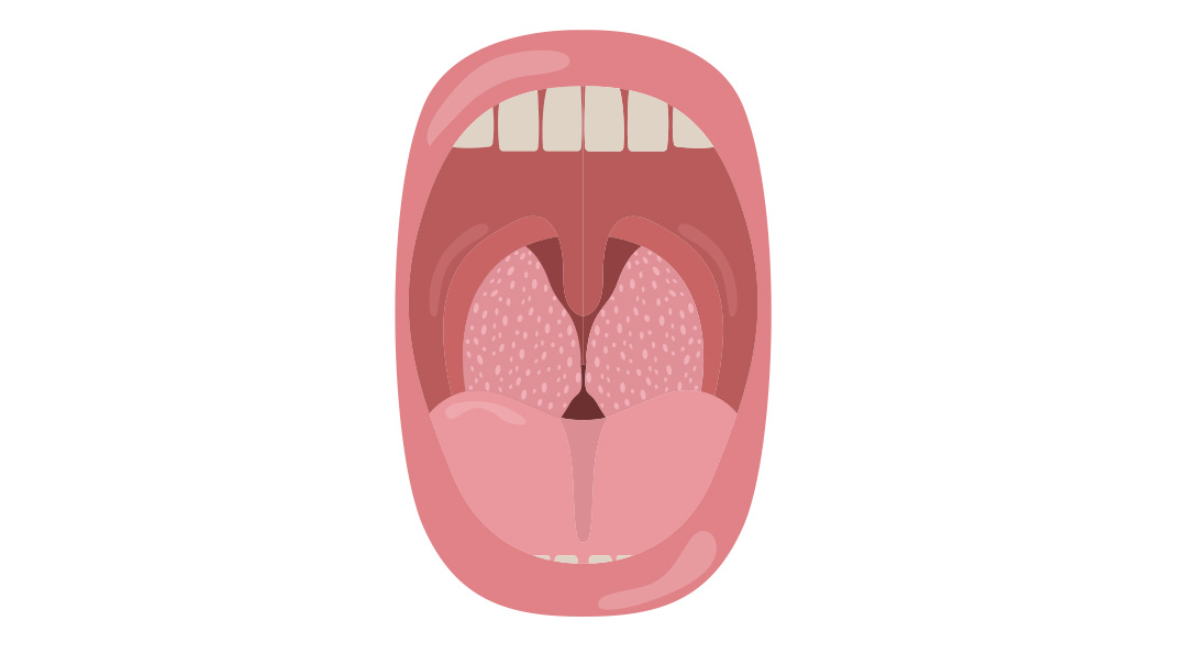 5 Things I Wish You Knew about Getting Your Adenoids Removed