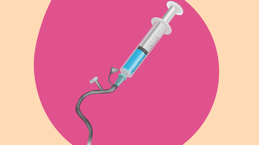 5 Things I Wish You Knew about Having an NG Tube  