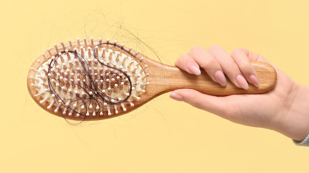 Five Things I Wish You Knew about Teens with Thinning Hair
